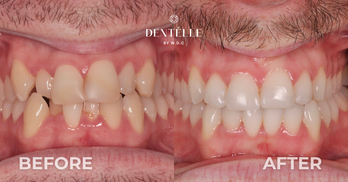 Orthodontics With Cosmetic Dentistry Clinical In Warragul