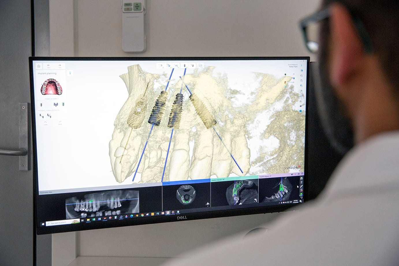 Finding the Right Dentist for All-On-4 Near Warragul (Without the Guesswork)
