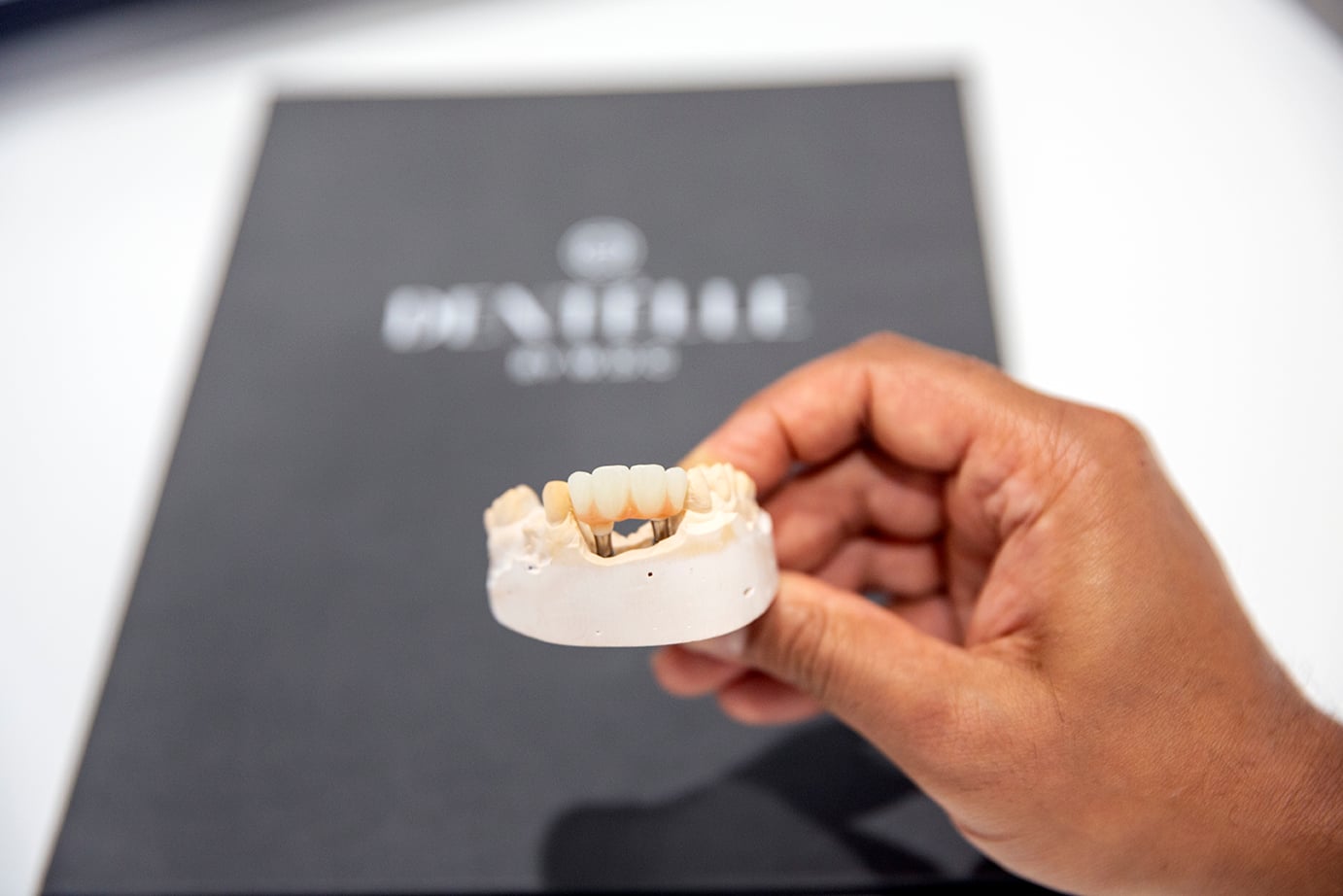 Missing Teeth? Here’s What You Actually Need to Know About Dental Implants in Warragul