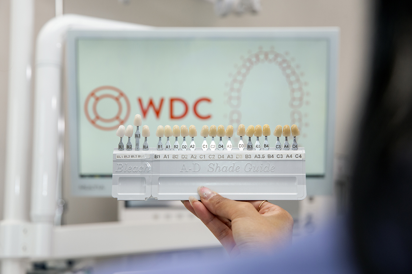 Teeth Whitening in Warragul VIC: Which Option Is Actually Right for You?