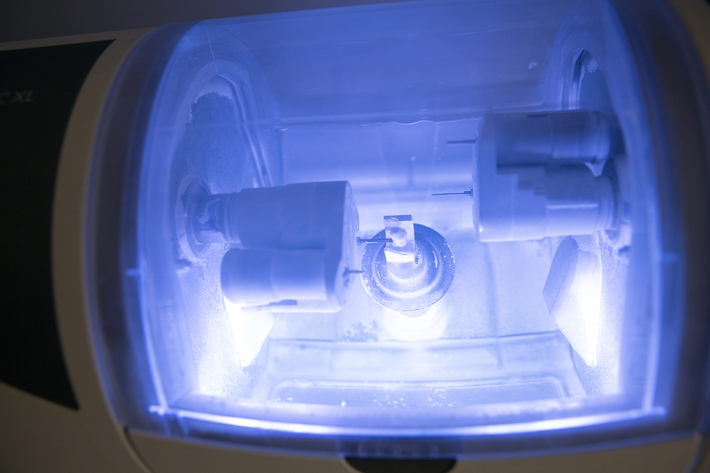 One Visit. One Crown. No Waiting Around. CEREC Same-Day Crowns at Dentélle Warragul