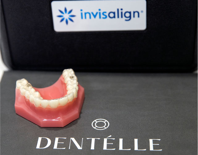 A Modern Approach To Teeth Straightening, In Warragul, Gippsland In Dentélle By Wdc