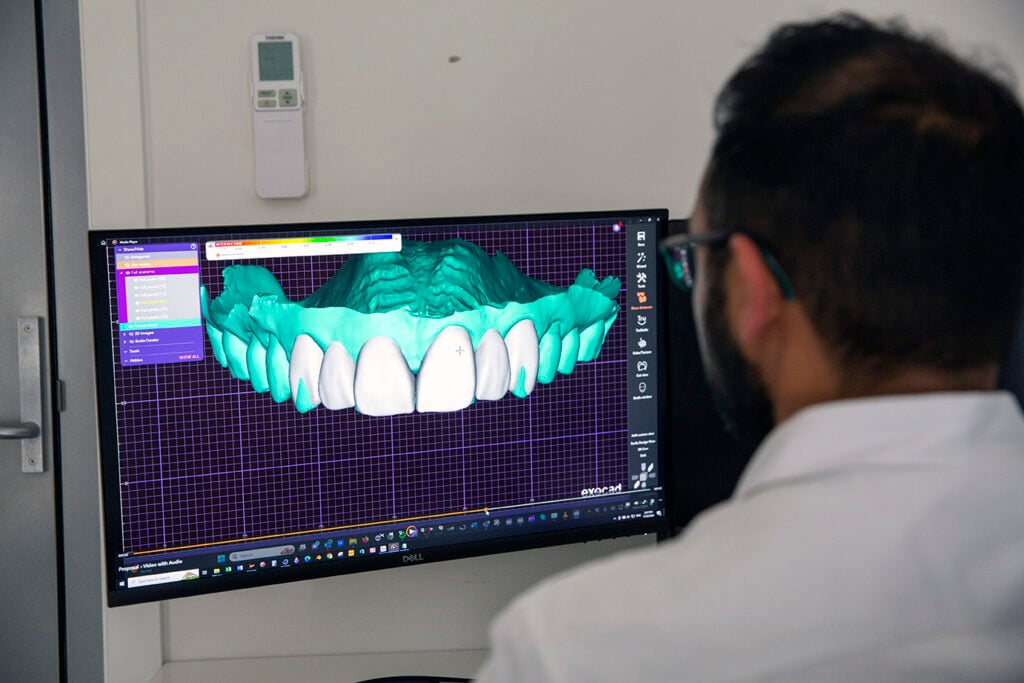 Cerec Same Day Dental Crowns Warragul