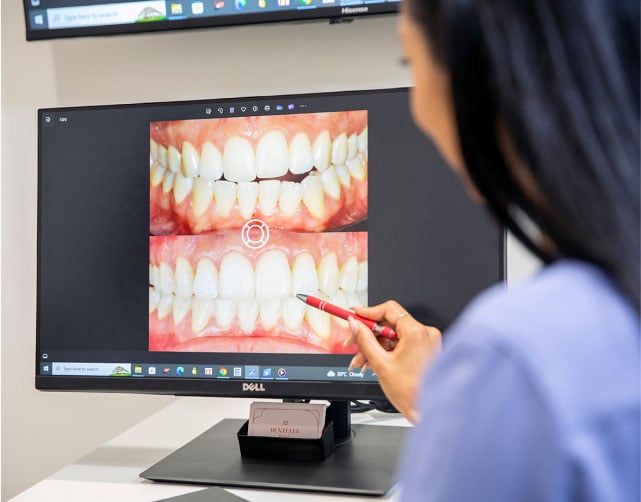 Find Your Beautiful New Smile Without Major Dental Work, In Warragul, Gippsland In Dentélle By Wdc