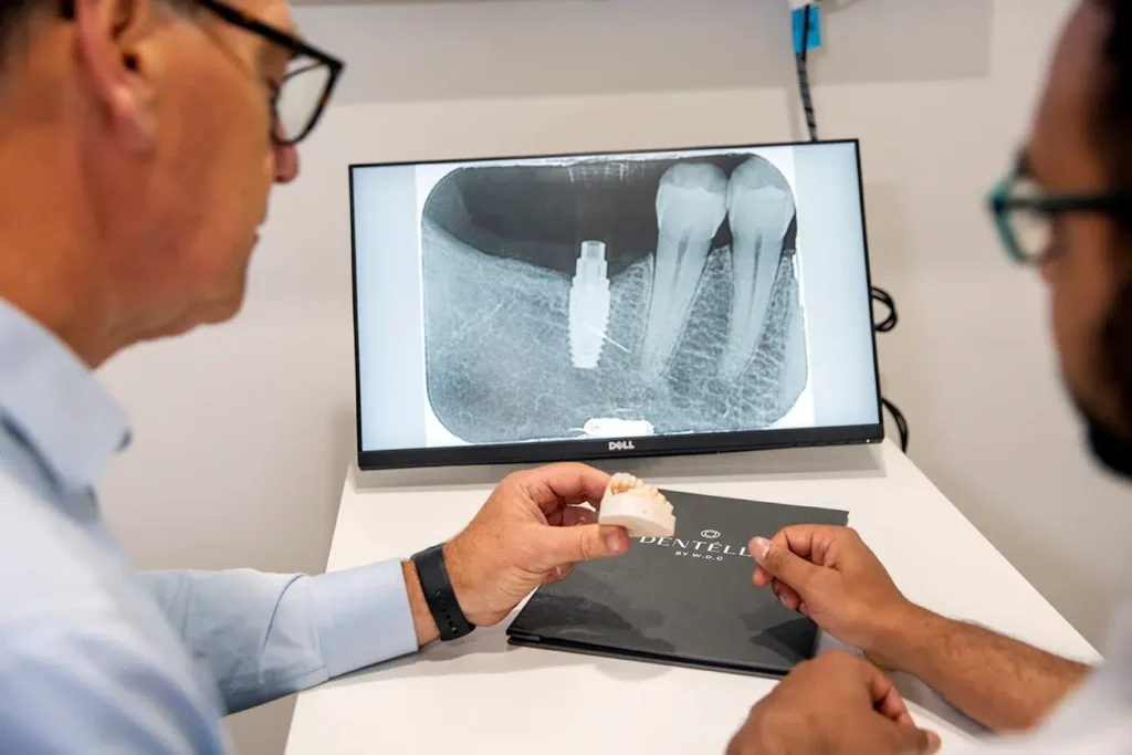 Full Mouth Dental Implants Smoking Warragul Gippsland