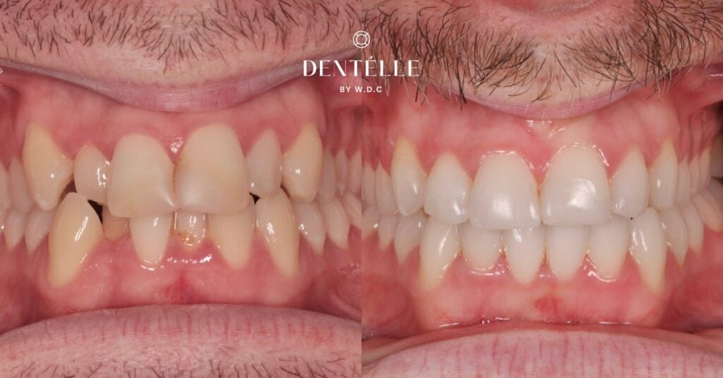 Orthodontics With Cosmetic Dentistry Clinical In Warragul