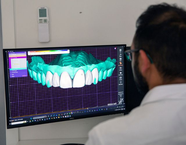 See Your New Smile Before Treatment Begins In Warragul, Gippsland In Dentélle By Wdc